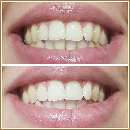 IMG-1118-1536x1536 IMG-1118-1536x1536