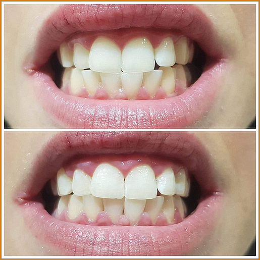 IMG-1120-1536x1536 IMG-1120-1536x1536